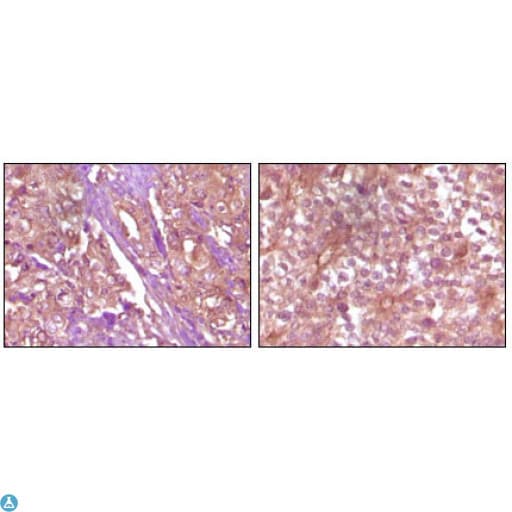 EPHB4 / EPH Receptor B4 Antibody