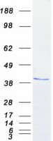 Human NPM1 / NPM / Nucleophosmin Protein (Recombinant Myc-DDK (Flag))
