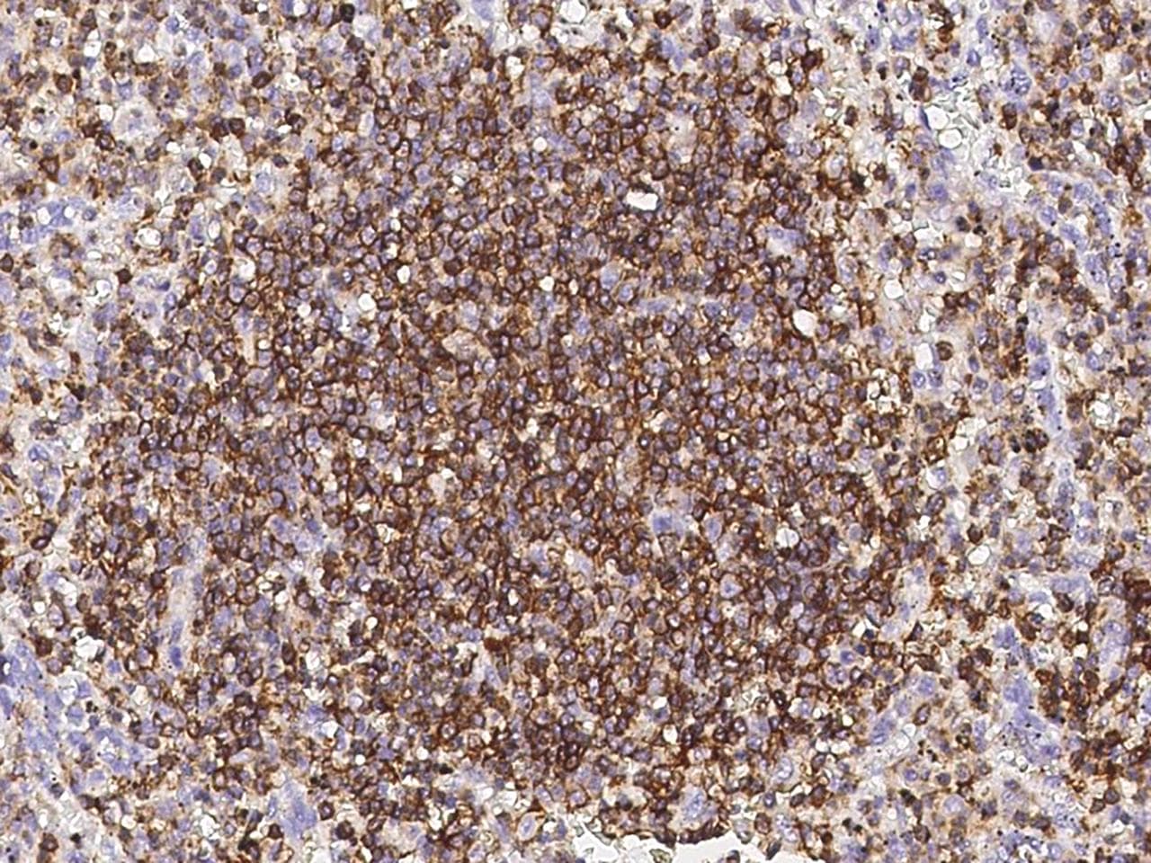 Monoclonal Rabbit anti-Human CD45 / LCA Antibody (clone 145, Preservative Free, IHC)