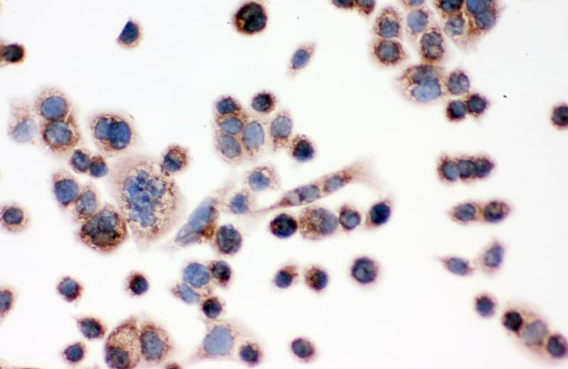 IDH2 Antibody (aa413-447)