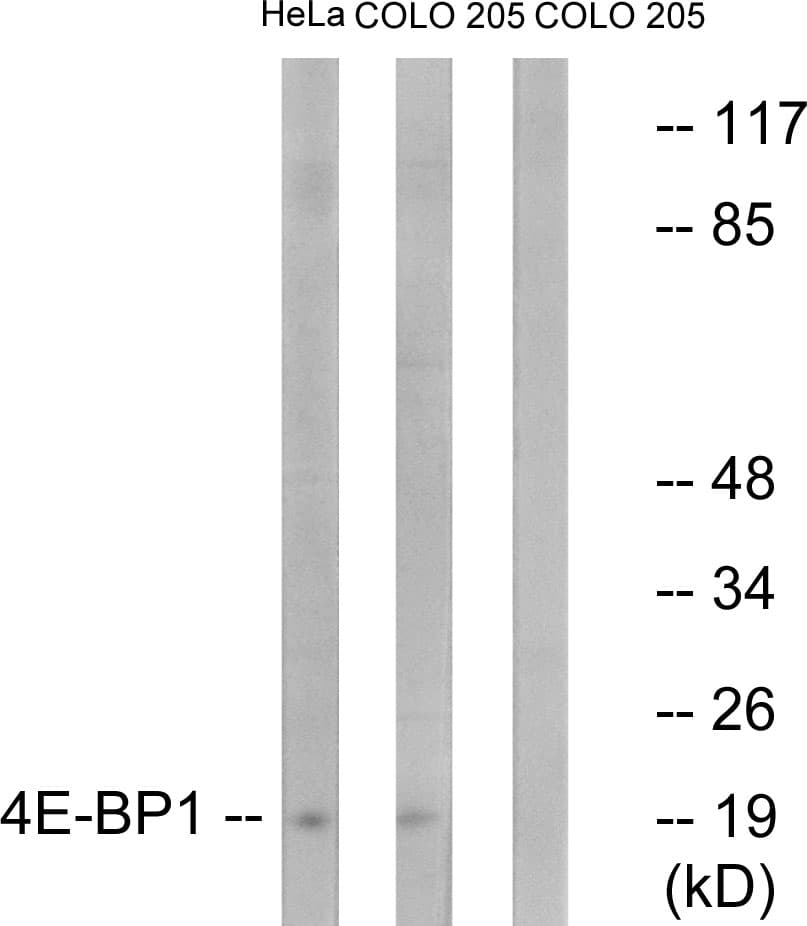 EIF4EBP1 / 4EBP1 Antibody (aa13-62)