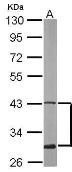 Polyclonal Rabbit anti-Human ATXN3 / JOS Antibody (aa1-245, IHC, WB)