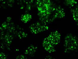 RPA2 / RFA2 / RPA34 Antibody (clone OTI7C12)