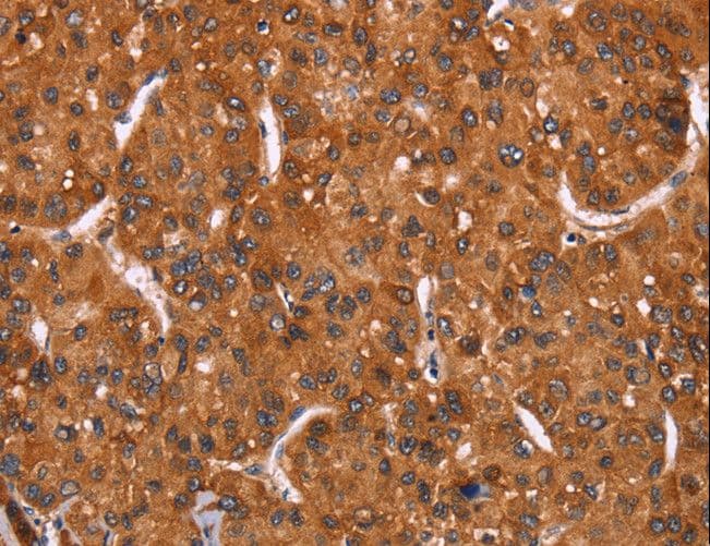HRK / HARAKIRI Antibody