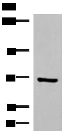 PAPSS2 Antibody