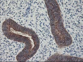 FDFT1 / Squalene Synthase Antibody (clone OTI1H9)