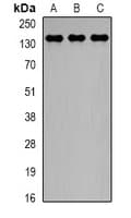 Polyclonal Rabbit anti-Human CTCF Antibody (IHC, WB)