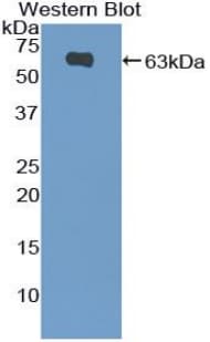 FRA-1 / FOSL1 Antibody (aa1-275)
