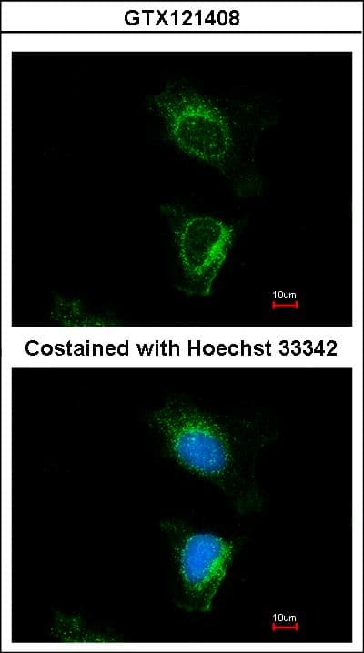 DUS2 / DUS2L Antibody