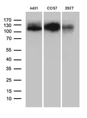 LAMP1 / CD107a Antibody (aa29-382, clone OTI1C5)