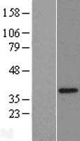 FAM164A / CGI-62 Protein (Over-Expression Lysate Myc-DDK (Flag))