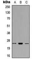 RNF125 / TRAC-1 Antibody (Internal)