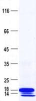 Human C11orf1 Protein (Recombinant His, N-Terminal)