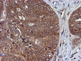 HARS2 Antibody (clone OTI5H2)
