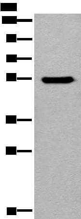 CYP11B2 / Aldosterone Synthase Antibody