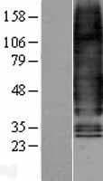 GCGR / Glucagon Receptor Protein (Over-Expression Lysate Myc-DDK (Flag))