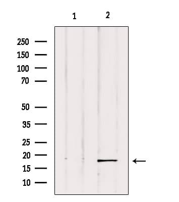 Polyclonal Rabbit anti-Human FAT10 / UBD Antibody (IHC, IF, WB)