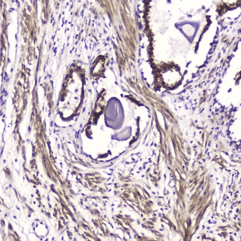 ATF4 Antibody