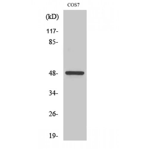 Polyclonal Rabbit anti-Human CSNK1G1 / CKI-Gamma 1 Antibody (1-80 aa, N-terminal, IHC, IF, WB)