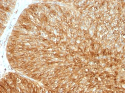 Recombinant Monoclonal Rabbit anti-Human B2M / Beta 2 Microglobulin Antibody (clone B2M/1857R, Azide-free,Carrier-free, IHC)