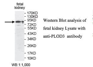 PLOD3 Antibody (aa254-508)
