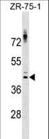 Polyclonal Rabbit anti-Human NKX2-1 / Thyroid-Specific TF Antibody (aa197-226, WB)
