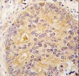 CAMKK2 Antibody (aa52-82)