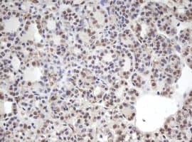 CBX8 Antibody (clone OTI6G4)