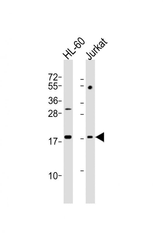 KISS1 / Kisspeptin / Metastin Antibody (aa20-52)