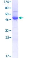 Human RANBP1 Protein (Recombinant GST)