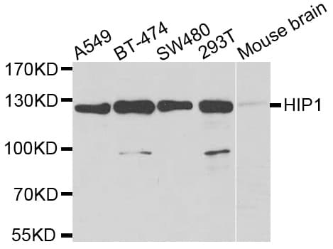 HIP1 Antibody