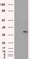 HMRF1L / MTRF1L Antibody (clone OTI2B5)