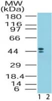 CRHR2 / CRF2 Receptor Antibody (aa75-125)