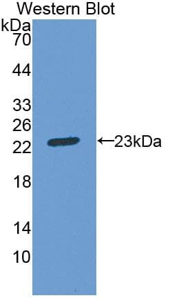 ACO1 / Aconitase Antibody (aa527-719, APC)