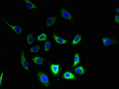 Polyclonal Rabbit anti-Human FAM168B Antibody (IHC)