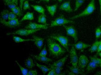NOX4 Antibody (aa100-200, DY488)