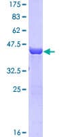 Human RAC2 Protein (Recombinant GST)