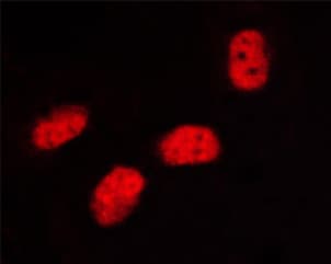 SP1 Antibody (phospho-Thr453)
