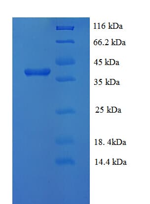 Rabies Virus Phosphoprotein (Recombinant His)