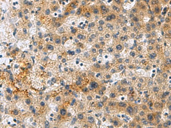 Polyclonal Rabbit anti-Human PLIN4 / S3-12 Antibody (IHC)