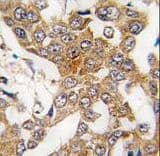Polyclonal Rabbit anti-Human BCL2L2 / Bcl-w Antibody (aa24-59, IHC, WB)