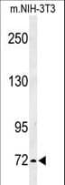 IL1RAPL2 Antibody (aa372-401)