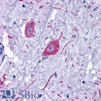 PathPlus™ Polyclonal Rabbit anti-Human GPR6 Antibody (C-Terminus, IHC)