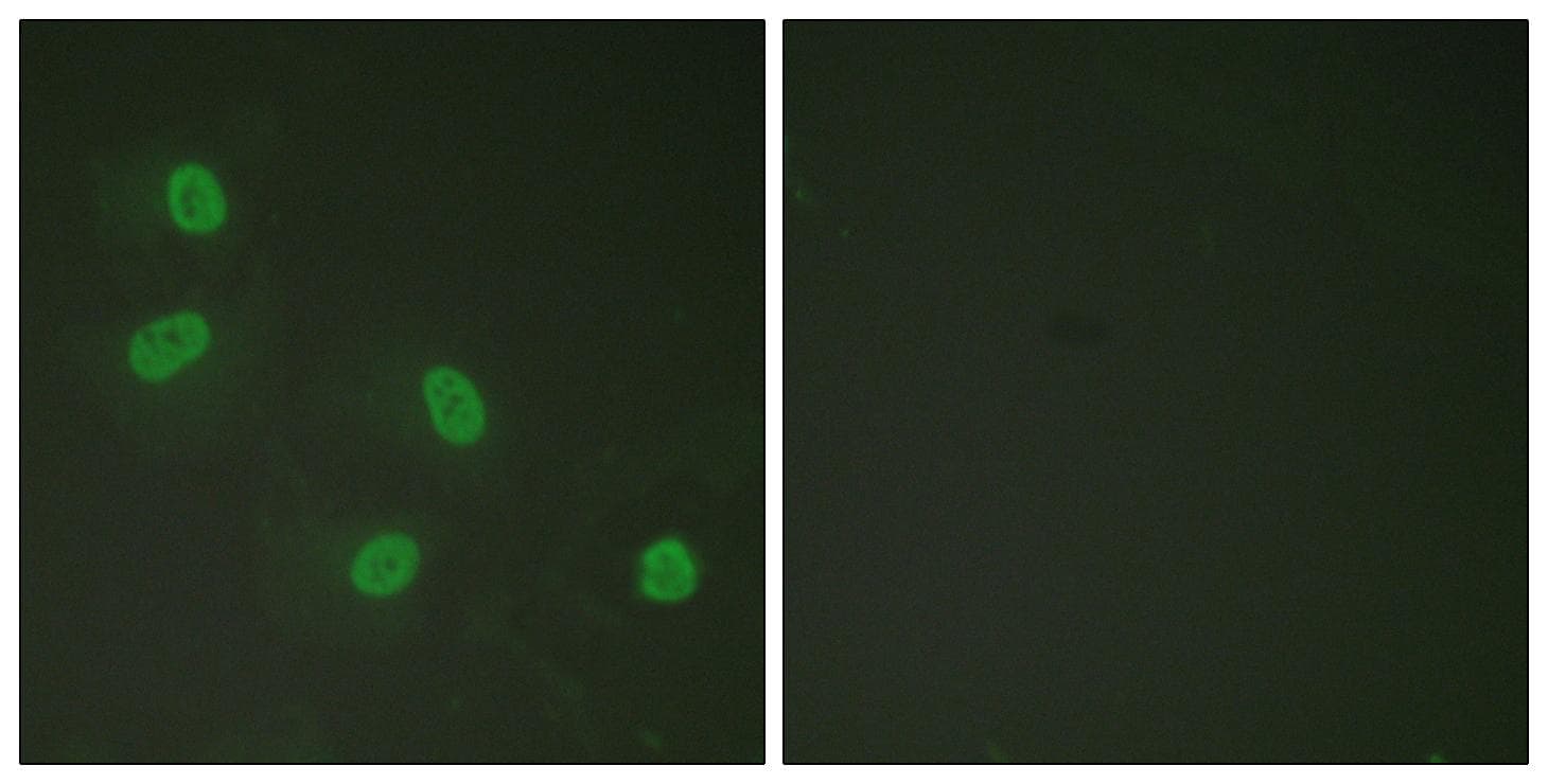 MED1 / TRAP220 Antibody (phospho-Thr1457)