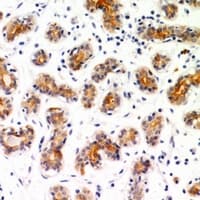 NDUFA7 Antibody