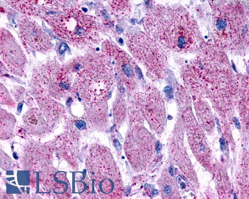 PathPlus™ Polyclonal Rabbit anti-Human LPAR3 / LPA3 / EDG7 Antibody (Cytoplasmic Domain, IHC)