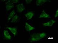 TARS Antibody (clone TARSF8H3)