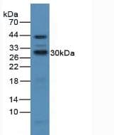 IL2RA / CD25 Antibody (aa22-213)