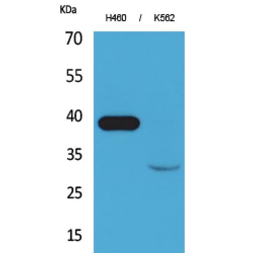 CTSL / Cathepsin L Antibody (Internal)