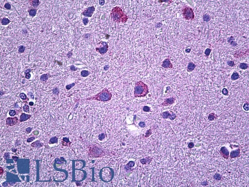 IHC-plus™ PROKR2/Prokineticin Receptor 2 Antibody (aa5-15)